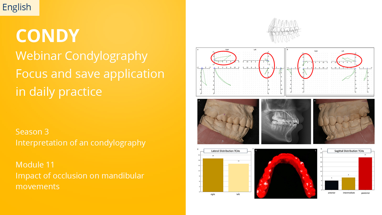 CONDYLOGRAPHY Season 3 – Module 11 – Impact of occlusion on mandibular movements