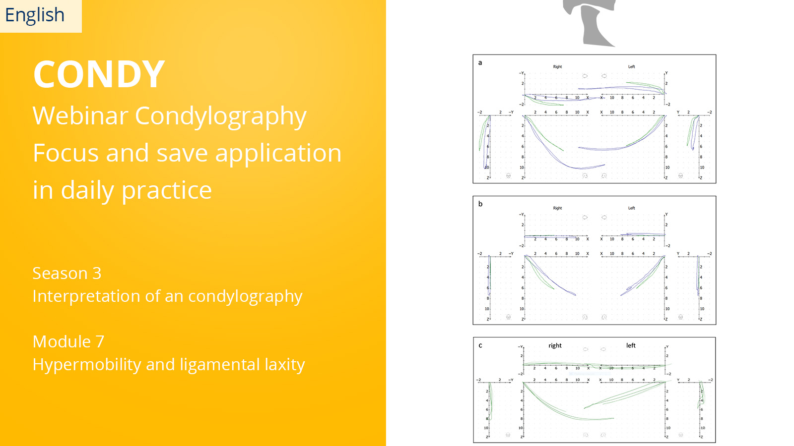 CONDYLOGRAPHY Season 3 – Module 7 – hypermobility and ligamental laxity