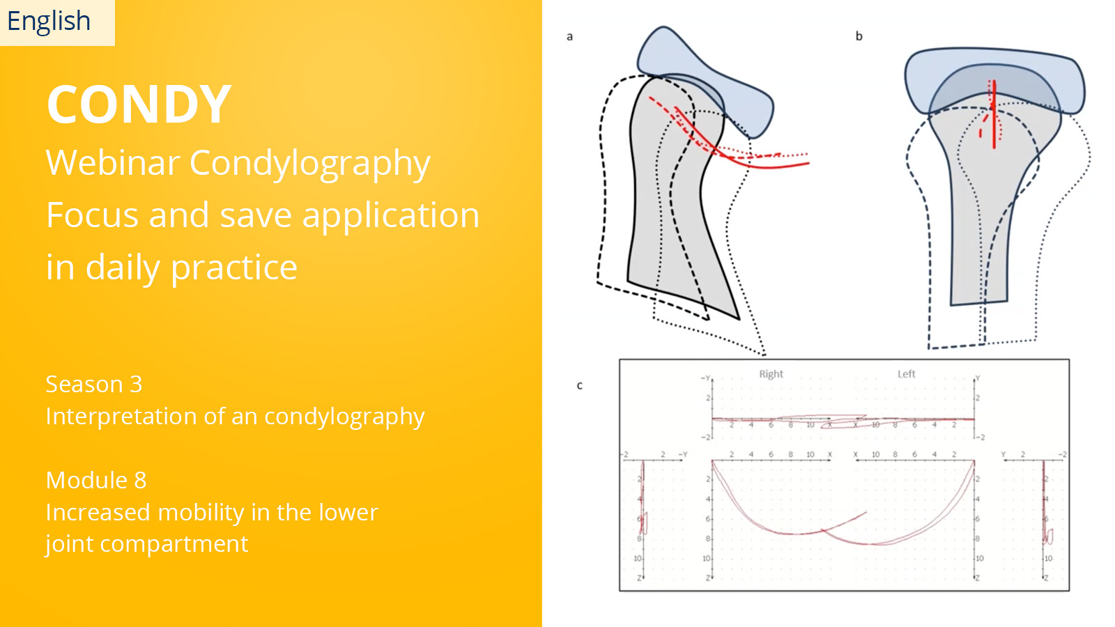 CONDYLOGRAPHY Season 3 – Module 8 – Increased mobility in the lower joint compartment